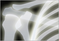 x ray X ray