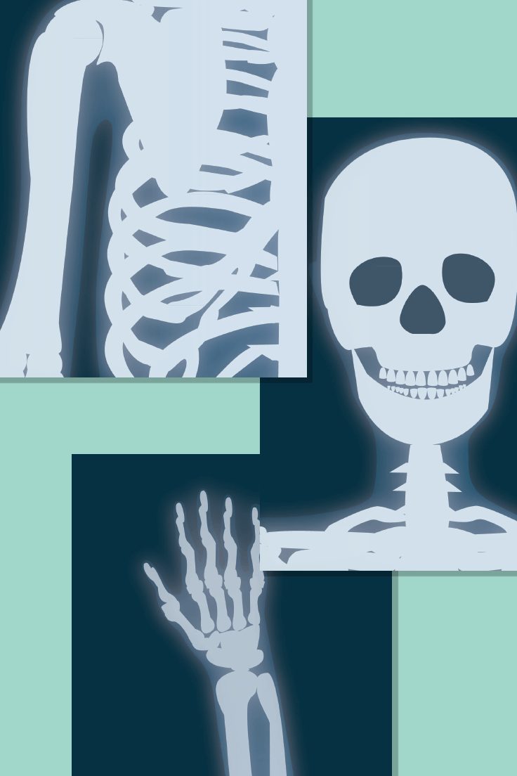 Illustrated X-Ray Posters